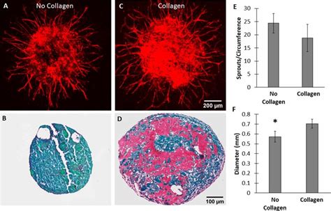 The Effects Of Collagen Incorporation On Organoid Vascularization