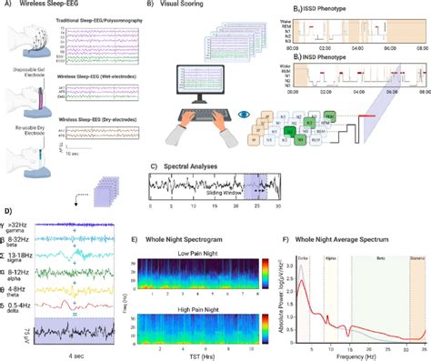 Summary of sleep-EEG techniques. (A) Visualization of the most common ...