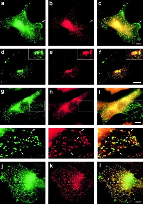 Mhip1r Colocalizes With Clathrin And Ap 2 In Cos 7 And Nih3t3