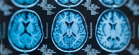 Functional MRI revealing how the brain processes emotions, MRI ...