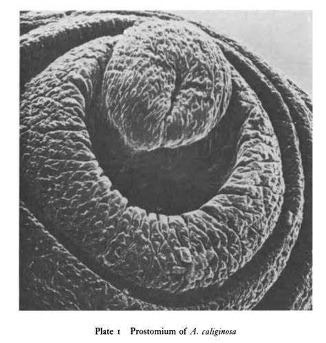 Prostomium & Peristomium | bioearthworm