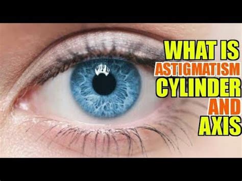 WHAT IS ASTIGMATISM CYLINDER AXIS YouTube