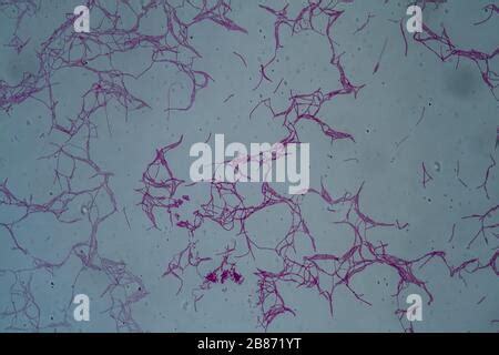 Bacillus anthracis anthrax under the microscope 200x Stock Photo - Alamy