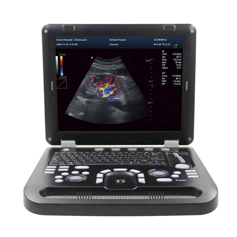 Ultrasound Scanner D D D Portable Color Doppler Ultrasonic