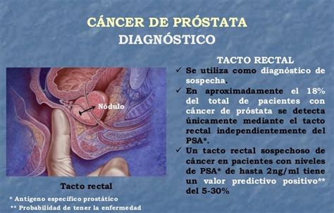 Cáncer De Próstata