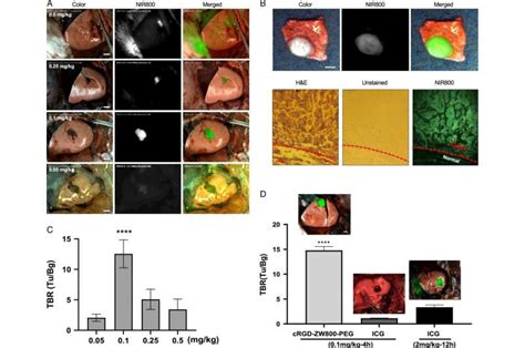 Dual Channel Fluorescence Imaging For Precise And Safe Pulmonary