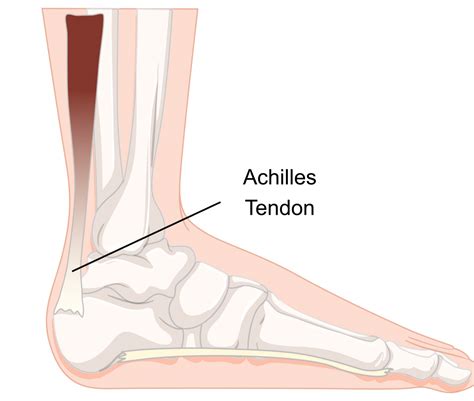 Achilles Tendon Anatomy Diagram