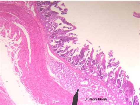 A Histology Tour of the GI Tract- The Duodenum