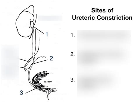 Lec Ureteric Constriction Diagram Diagram Quizlet