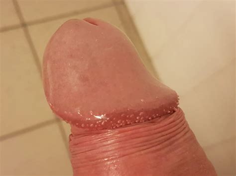 Gland Nude Pics Xhamster