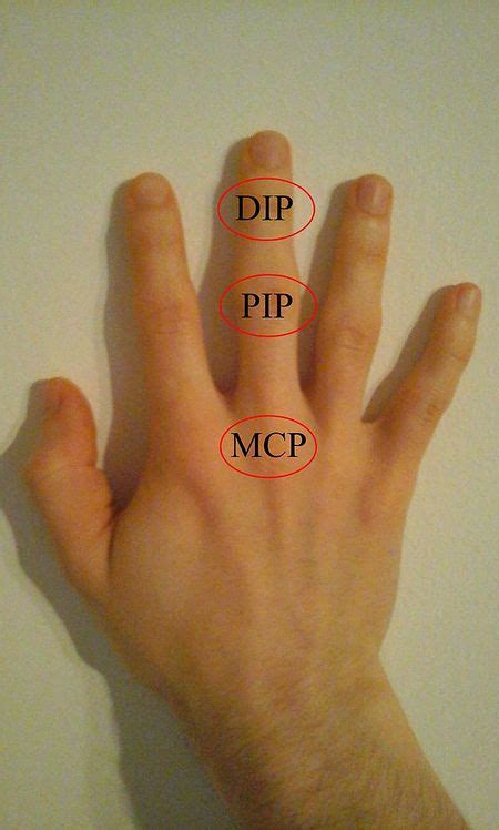 Interphalangeal Joints Of The Hand Physiopedia