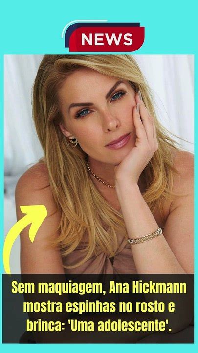 Sem Maquiagem Ana Hickmann Mostra Espinhas No Rosto E Brinca Uma