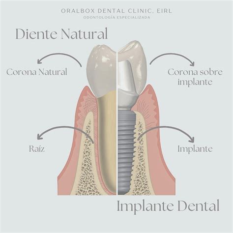 Oralbox Dental Clinic 🦷 (@oralboxdentalclinic) • Instagram photos and ...