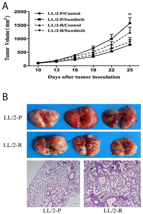 Decreased Growth Inhibitory Effect Of Sunitinib And Enhanced Metastatic