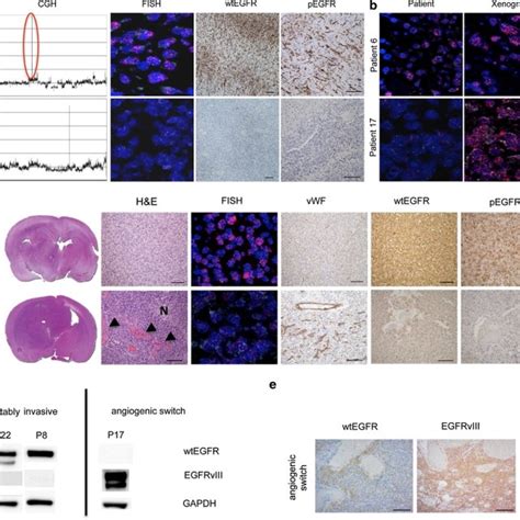 Egfr Activation Promotes Invasive Non Angiogenic Tumor Growth In Gbm