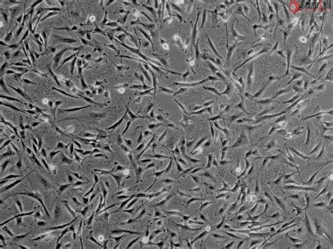 Human Pulmonary Artery Smooth Muscle Cells Hpasmc