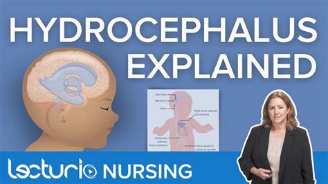 Hydrocephalus Definition Symptoms And Nursing Interventions Lecturio Nursing Pediatrics