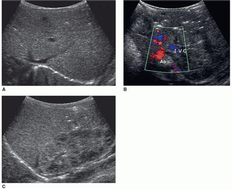 The Liver Radiology Key