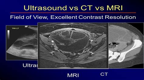 47 Best Photos Cat Scan Vs Mri Vs Xray Ct Scan Vs Ultrasound Hot Sex Picture