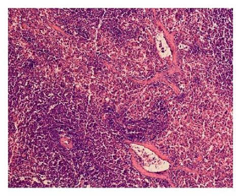 Photomicrographs Of Spleen From Wistar Kyoto Rats A And B Without