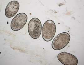 Scabies Causes, Pictures ,Prevention and Treatment