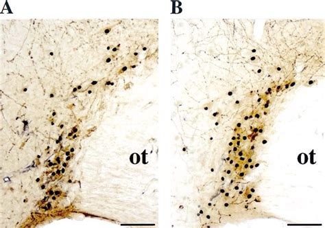 Photomicrographs Illustrating Labeled Magnocellular Neurons In The Download Scientific Diagram