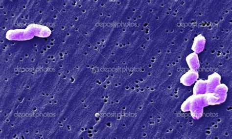 Salmonella Under Microscope