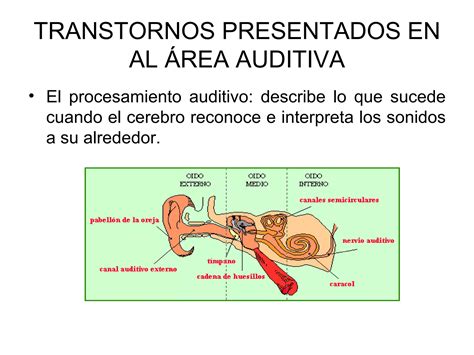 Transtornos Auditivos Diapositivas PPT