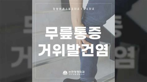 신사역 정형외과 무릎이 뜨거워요 열감 원인 거위발건염이란 네이버 블로그