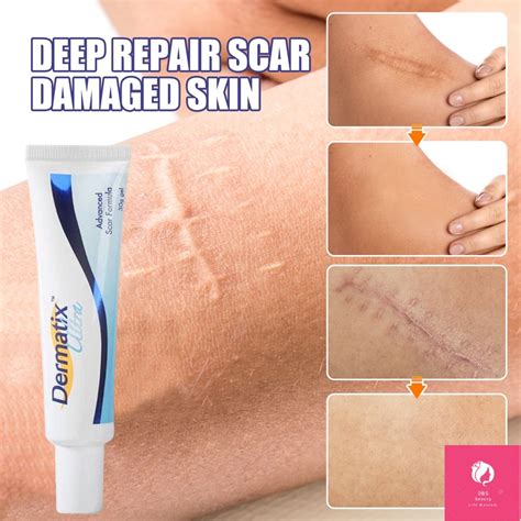 Contractubex Scar Gel Original Australia Dermatix Scar Gel Acne Scars