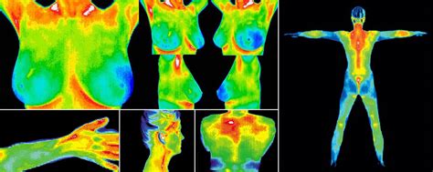 What Is Thermography The Breast Thermography Center