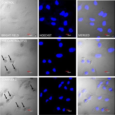 Hoechst staining. Nuclear morphological changes were observed through ...