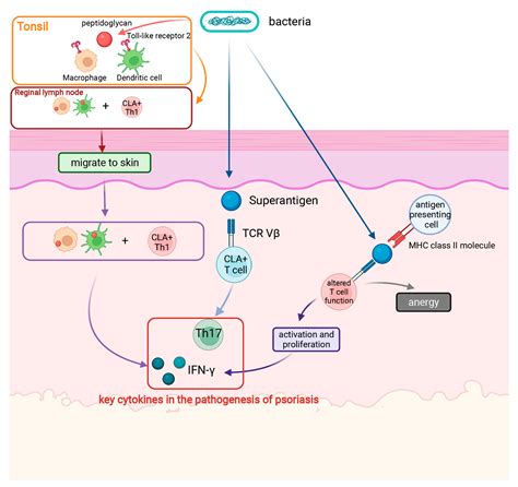 IJMS Free Full Text Roles Of Infection In Psoriasis