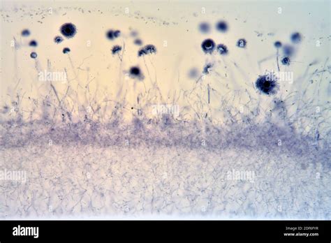 Conidia De Aspergillus Un Hongo De Ascomycota Microscopio óptico X100