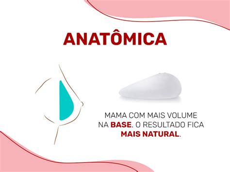 Tipos de Prótese de Silicone Tudo que você precisa saber