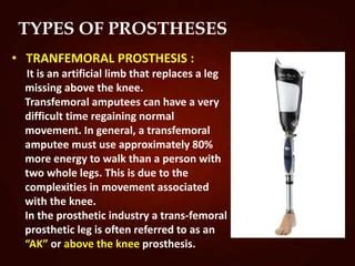 Prosthetic devices | PPT