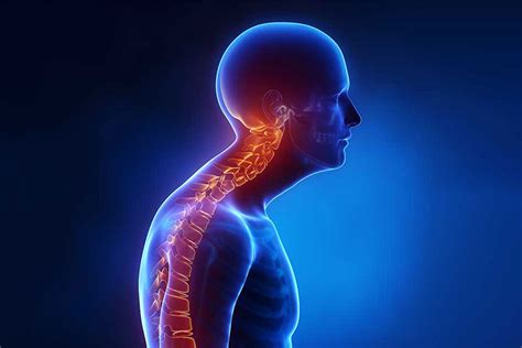 Cervical Kyphosis - MedWorld Clinic | Rixos, Antalya, Turkey