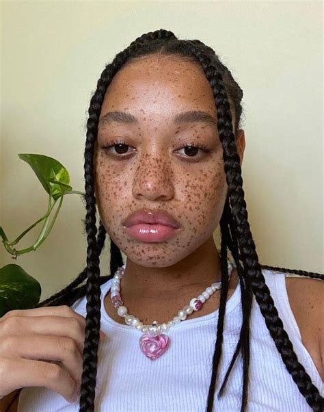 Beautiful Black Woman With Freckles And Braids