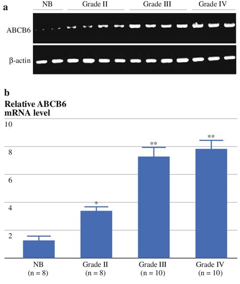 Abcb6 Mrna Levels In Human Malignant Glioma Specimens Were