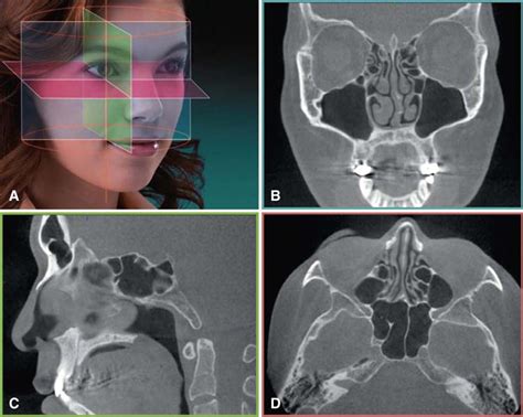 Cone Beam Computed Tomography CBCT OPDSF Orthodontics 50 OFF