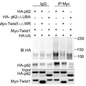 P62 Interacts With Twist1 A Co Immunoprecipitation Co IP Analysis