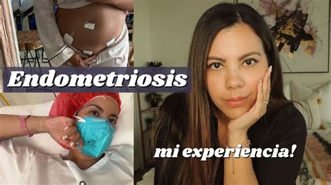 Mi Experiencia Con Endometriosis Sintomas Diagn Stico Cirugia