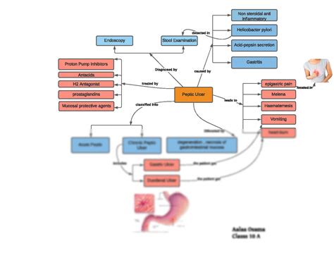 Peptic Ulcer Disease Concept Map Planned Unit Development Png Clipart