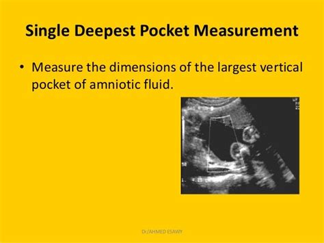 14 Amniotic Fluid Imaging Dr Ahmed Esawy