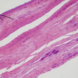 Scoring Criteria Used For The Semi Quantitative Histological Analysis