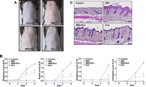 Dun Treatment Ameliorates Imq Induced Skin Lesions In C57bl 6 Mice A Download Scientific