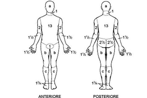 The Rule Of Nines To Calculate Burns Medizzy Off