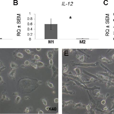 Validation Of Macrophage Polarization Qpcr Was Done Using Markers For