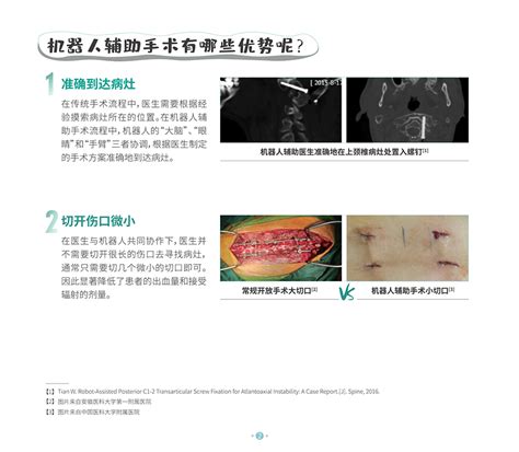 天玑骨科机器人微科普 微科普 Tinavi Medical Doing orthopedic Robotic assisted