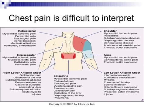 Pinpoint Pain In Chest Left Side Suppliesstat